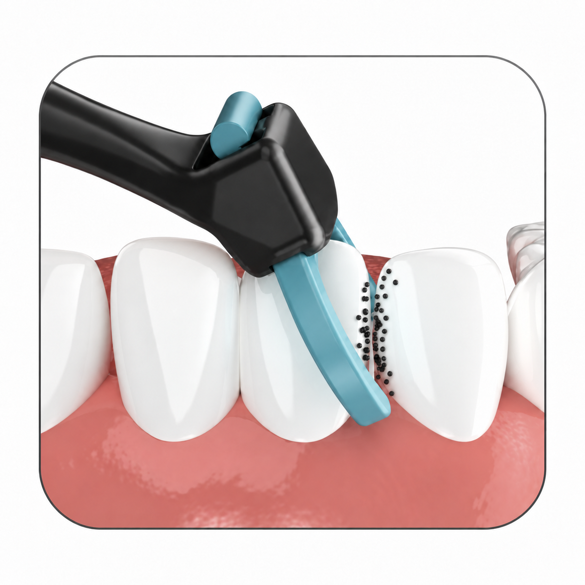 5th Surface Electric Flosser